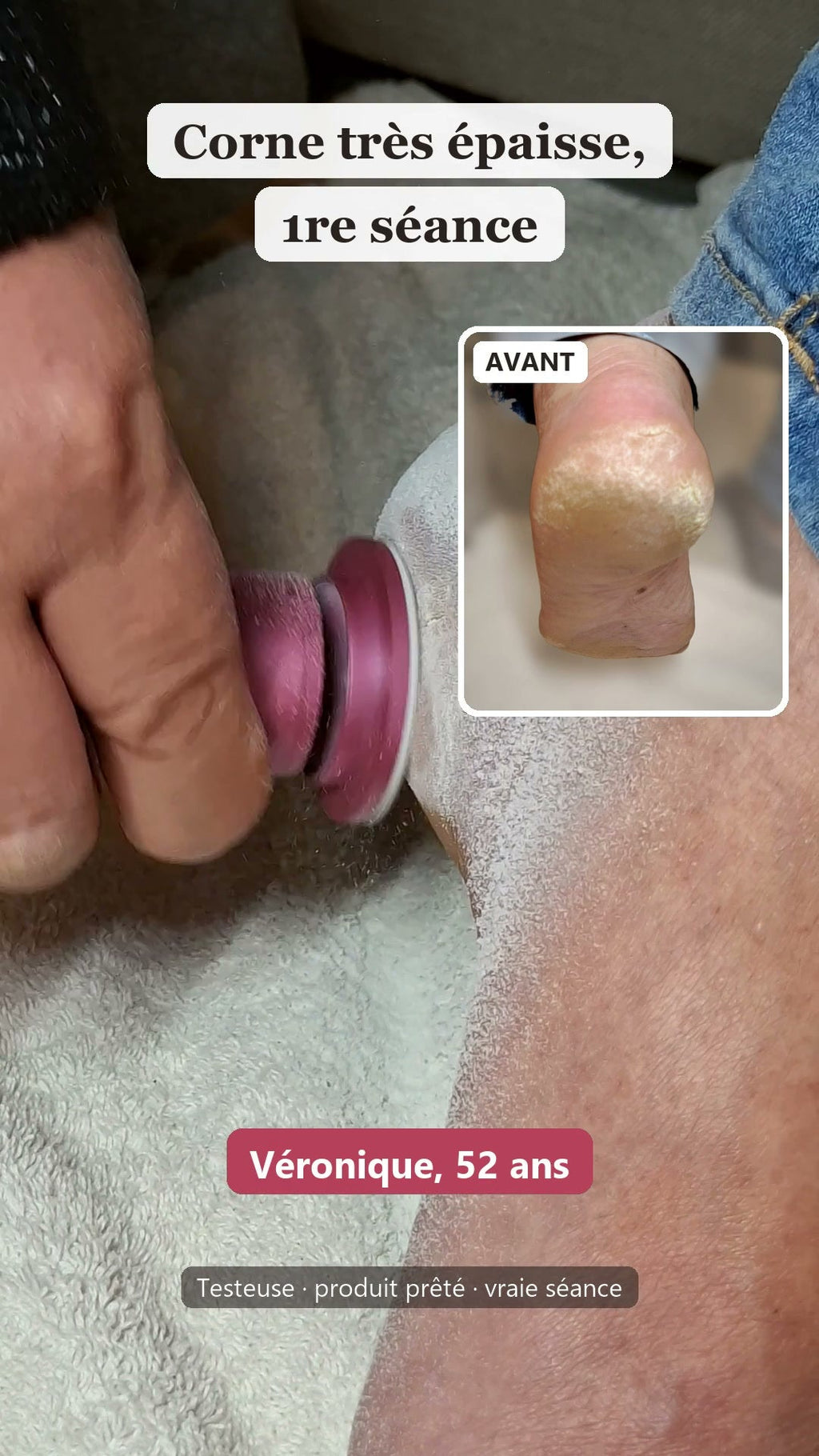 Vidéo d'une vraie séance avec Velours Nomade chez deux testeuses, Véronique 52 ans et Carmen 72 ans : la corne très épaisse du talon part en poussière, puis leurs photos avant / après une seule séance.